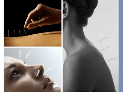 Acupunture Studio